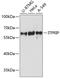 Inositol 1,4,5-Trisphosphate Receptor Interacting Protein antibody, 14-118, ProSci, Western Blot image 