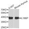 Interleukin 18 Binding Protein antibody, abx004938, Abbexa, Western Blot image 