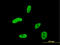 HOXA9 antibody, LS-C197435, Lifespan Biosciences, Immunofluorescence image 