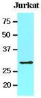 Tyrosine 3-Monooxygenase/Tryptophan 5-Monooxygenase Activation Protein Theta antibody, GTX53680, GeneTex, Western Blot image 