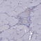 Steroidogenic Acute Regulatory Protein antibody, HPA023644, Atlas Antibodies, Immunohistochemistry frozen image 