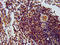 THO complex subunit 5 homolog antibody, LS-C672406, Lifespan Biosciences, Immunohistochemistry paraffin image 