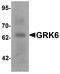 G Protein-Coupled Receptor Kinase 6 antibody, A03623-1, Boster Biological Technology, Western Blot image 