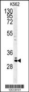 Chromosome 2 Open Reading Frame 49 antibody, 61-829, ProSci, Western Blot image 