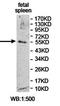 Phospholipase D Family Member 4 antibody, orb78324, Biorbyt, Western Blot image 