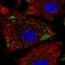 Keratin 222 antibody, HPA069774, Atlas Antibodies, Immunofluorescence image 