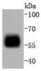 Interferon Regulatory Factor 5 antibody, A00958, Boster Biological Technology, Western Blot image 