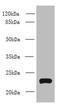 Transmembrane Protein 222 antibody, A61402-100, Epigentek, Western Blot image 