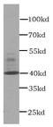 C-X-C Motif Chemokine Receptor 3 antibody, FNab02101, FineTest, Western Blot image 