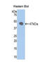 Selectin E antibody, LS-C296356, Lifespan Biosciences, Western Blot image 