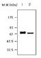Serpin Family A Member 3 antibody, LS-C62020, Lifespan Biosciences, Western Blot image 