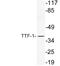 NK2 Homeobox 1 antibody, LS-C177294, Lifespan Biosciences, Western Blot image 