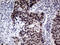 Tousled Like Kinase 2 antibody, LS-C790626, Lifespan Biosciences, Immunohistochemistry paraffin image 