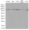 STAT3 antibody, GTX83549, GeneTex, Western Blot image 