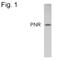 Nuclear Receptor Subfamily 2 Group E Member 3 antibody, PA1-809, Invitrogen Antibodies, Western Blot image 