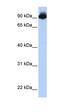 Oxytocin/Neurophysin I Prepropeptide antibody, orb330205, Biorbyt, Western Blot image 