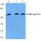 Signal Transducing Adaptor Molecule 2 antibody, A06533Y192, Boster Biological Technology, Western Blot image 