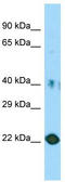 Placenta Expressed Transcript 1 antibody, TA332179, Origene, Western Blot image 