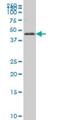 Forkhead Box A2 antibody, H00003170-M12, Novus Biologicals, Western Blot image 