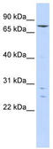Kelch Like Family Member 4 antibody, TA345270, Origene, Western Blot image 