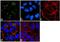 Intercellular Adhesion Molecule 1 antibody, MA5407, Invitrogen Antibodies, Immunofluorescence image 