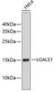Galectin 1 antibody, 18-793, ProSci, Western Blot image 
