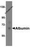 Albumin antibody, A01245, Boster Biological Technology, Western Blot image 