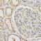 Propionyl-CoA Carboxylase Subunit Beta antibody, PA5-76738, Invitrogen Antibodies, Immunohistochemistry paraffin image 