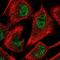 6-Phosphofructo-2-Kinase/Fructose-2,6-Biphosphatase 3 antibody, PA5-65372, Invitrogen Antibodies, Immunofluorescence image 