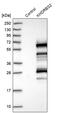 KH RNA Binding Domain Containing, Signal Transduction Associated 2 antibody, PA5-56127, Invitrogen Antibodies, Western Blot image 