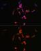 Phosphatidylinositol-4,5-Bisphosphate 3-Kinase Catalytic Subunit Alpha antibody, GTX55747, GeneTex, Immunofluorescence image 