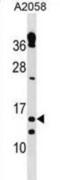 Thioredoxin reductase 3 intronic transcript 1 antibody, abx030775, Abbexa, Western Blot image 