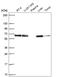 Acyl-CoA Thioesterase 2 antibody, HPA060170, Atlas Antibodies, Western Blot image 