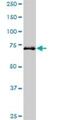 Hedgehog Interacting Protein antibody, H00064399-M01, Novus Biologicals, Western Blot image 