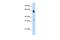 Lysine Demethylase 4D antibody, A07780, Boster Biological Technology, Western Blot image 