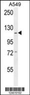 Gamma-Aminobutyric Acid Type B Receptor Subunit 2 antibody, 55-090, ProSci, Western Blot image 
