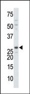 Deoxythymidylate Kinase antibody, AP13620PU-N, Origene, Western Blot image 