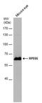 Retinoid Isomerohydrolase RPE65 antibody, PA5-78414, Invitrogen Antibodies, Western Blot image 