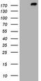 ALK Receptor Tyrosine Kinase antibody, TA800705BM, Origene, Western Blot image 