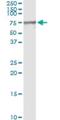 Mesothelin antibody, H00010232-M02, Novus Biologicals, Immunoprecipitation image 