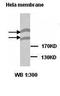 Plexin B1 antibody, orb76909, Biorbyt, Western Blot image 