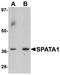 Spermatogenesis Associated 1 antibody, TA326615, Origene, Western Blot image 