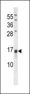 BGP antibody, LS-C97648, Lifespan Biosciences, Western Blot image 