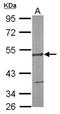 SWI/SNF Related, Matrix Associated, Actin Dependent Regulator Of Chromatin, Subfamily D, Member 3 antibody, NBP2-15121, Novus Biologicals, Western Blot image 