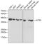 Actin Related Protein 2 antibody, 19-823, ProSci, Western Blot image 