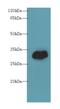 Phosphatidylinositol-4,5-Bisphosphate 4-Phosphatase 2 antibody, LS-C376871, Lifespan Biosciences, Western Blot image 