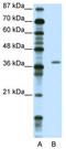 Zinc Finger Protein 444 antibody, TA345248, Origene, Western Blot image 