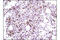 GATA Binding Protein 1 antibody, 3535S, Cell Signaling Technology, Immunohistochemistry paraffin image 