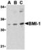 BMI1 Proto-Oncogene, Polycomb Ring Finger antibody, A00313, Boster Biological Technology, Western Blot image 