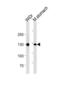 Cadherin 1 antibody, abx034792, Abbexa, Western Blot image 